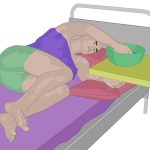 K&ouml;rperpflege von Hemiparese-Betroffenen