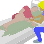 Pflege von Hemiplegie