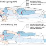 LiN&reg;Lagerung in Neutralstellung