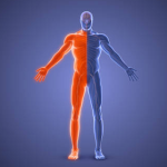 Mit einer Hemiplegie leben