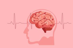 Schlaganfalltherapie mit Virtual-Reality-Computerspiel